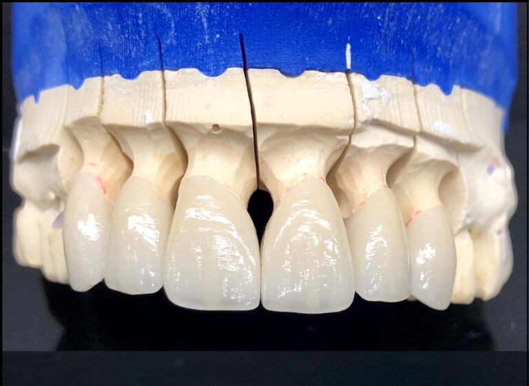 Inter Pro Dental Lab